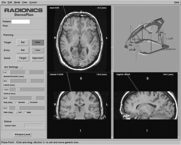 Journal brain image